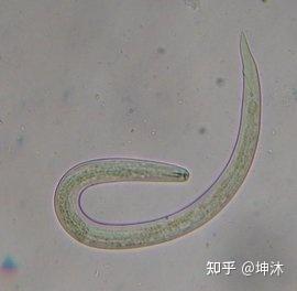 女子跟风生吃彩椒碗，意外感染钩虫，健康警钟敲响的背后