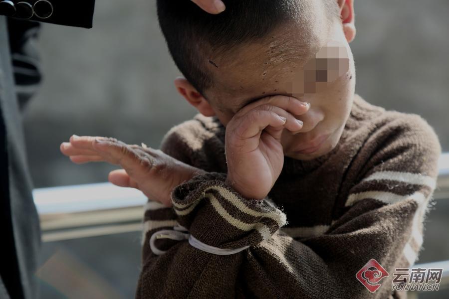 失踪的星光，大理洱海畔12岁自闭症少年的奇迹回归