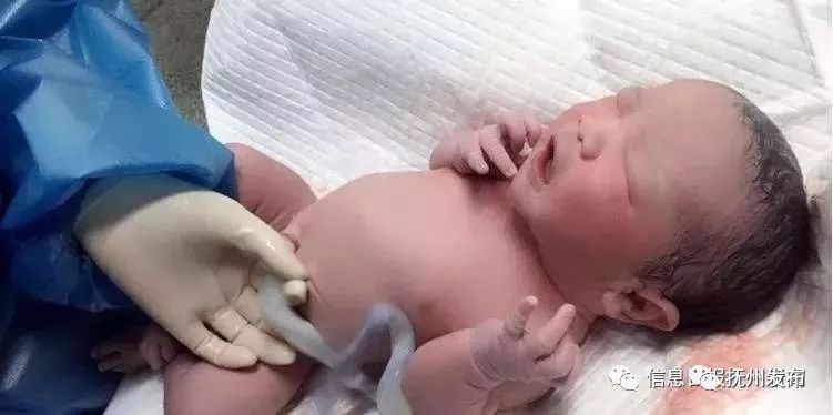 54岁高龄产妇的奇迹，腰椎手术后怀孕产女