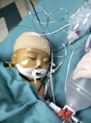 重庆完成首例成人亲体辅助肝移植，生命之光的温暖传递