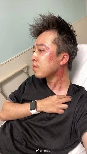 华人职业拳击手在澳大利亚遭遇暴力袭击，种族与体育的双重挑战