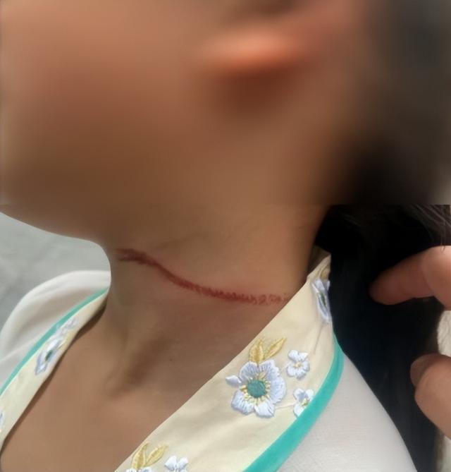 洱海畔的网红之殇，歪脖子树疑遭人为砍断的背后