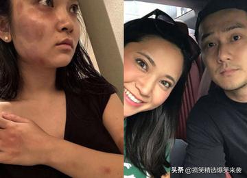 许昕，在聚光灯下道歉，照亮人生的裂缝