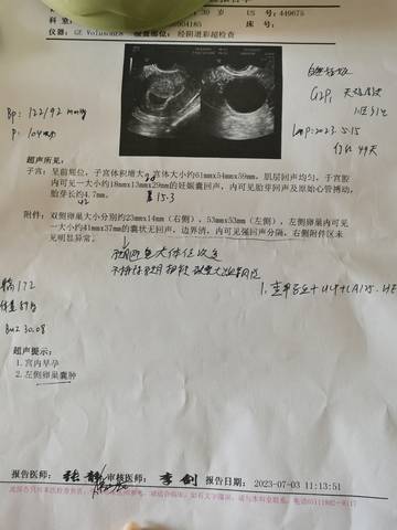 医学影像中的性别迷雾，当CT报告显示子宫未见异常