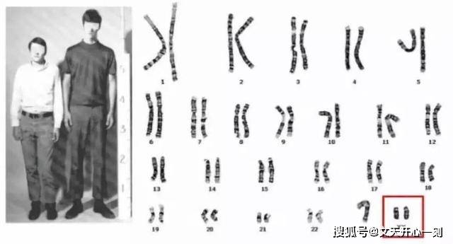 婚后三年未育之谜，揭开男性染色体异常的隐秘