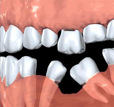 校园健康隐患引关注,教体局回应学校排查牙龈出血病例事件 校园健康隐患引关注,教体局回应学校排查牙龈出血病例事件
