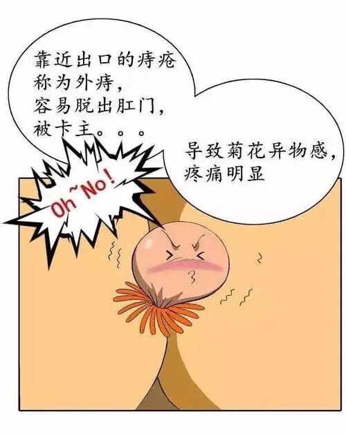 血色术后痛,华裔女子痔疮手术竟成生死劫 血色术后痛,华裔女子痔疮手术竟成生死劫